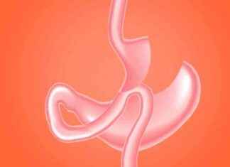 جراحات السمنة: الحماية الأفضل للكلى من أوزمبيك news-22092024-164115