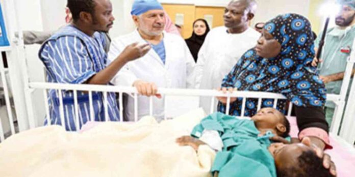 نجاح فصل التوأم الملتصق البوركيني حوى وخديجة - تفاصيل العملية والتحضيرات