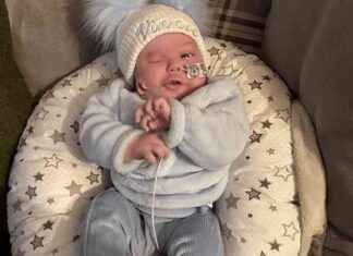 لماذا يُولد بعض الأطفال بأذن على الخد؟