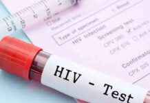 قاح جديد لفيروس نقص المناعة البشرية: نتائج مبكرة واعدة