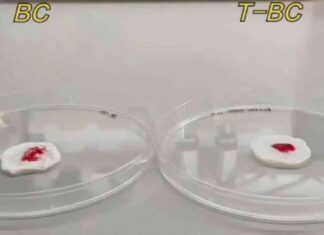 ضمادة مبتكرة لتسريع التئام الحروق