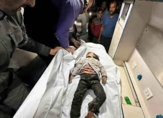 شهادة طبيب إسباني عن فاجعة موت الأطفال في غزة