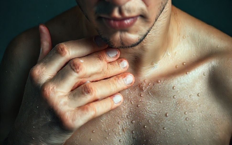 التعرق الزائد أم مرض؟ كيف تعرف الفرق؟*