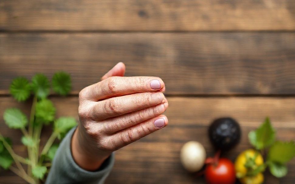 كيفية التخلص من الحموضة والحرقان بشكل طبيعي دون أدوية