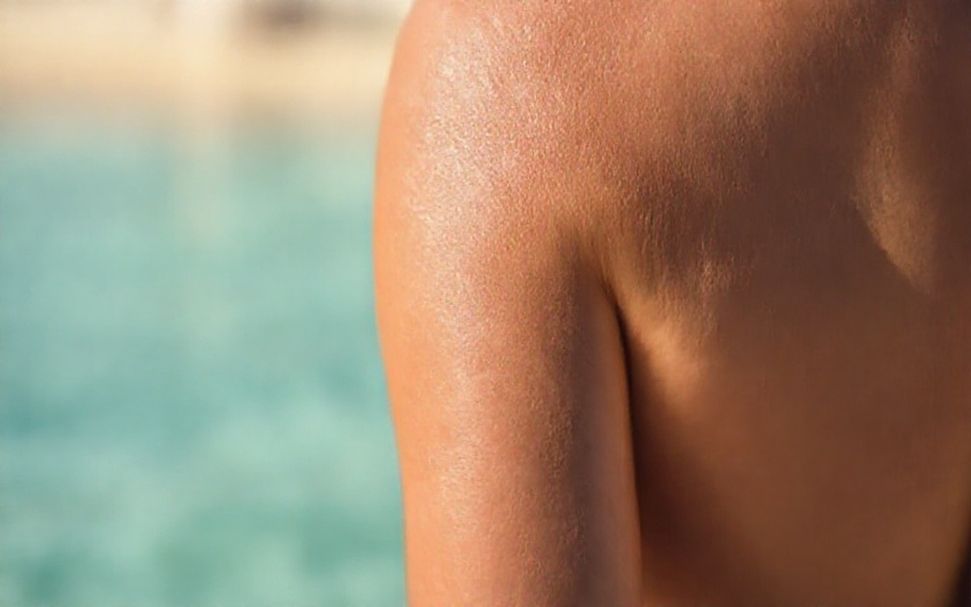 ما يجب فعله فور حدوث حروق الشمس: خطوات الطوارئ*