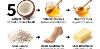 5 وصفات طبيعية لعلاج تشققات الكعبين خلال أسبوعين فقط