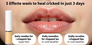 5 حلول فعالة لإصلاح تشقق الشفاه في 3 أيام فقط