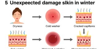 البرودة تضر البشرة ب 5 تأثيرات غير متوقعة خلال الشتاء