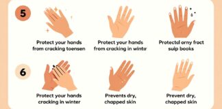 5 طرق فعالة لحماية يديك من التشقق في فصل الشتاء